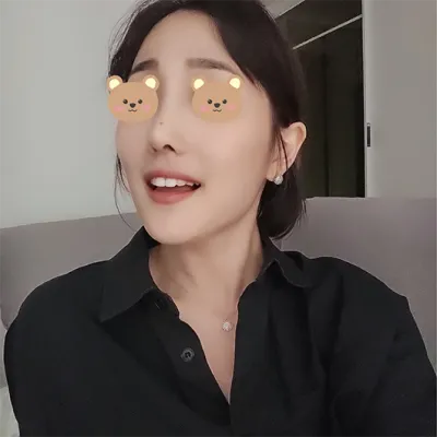 Thoát khỏi dáng mũi diều hâu thấp!!!! Mình đã thành công rồi~