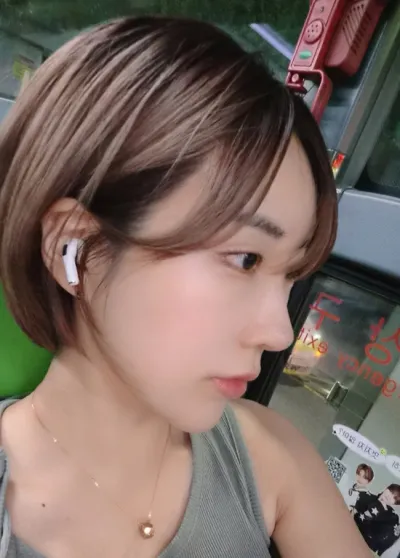 Tròn một tháng mình làm lại mũi + hạ xếch tại Want♥