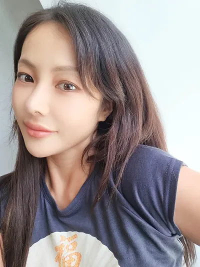 Review mình phẫu thuật lại mũi từ Viện trưởng Kim S2