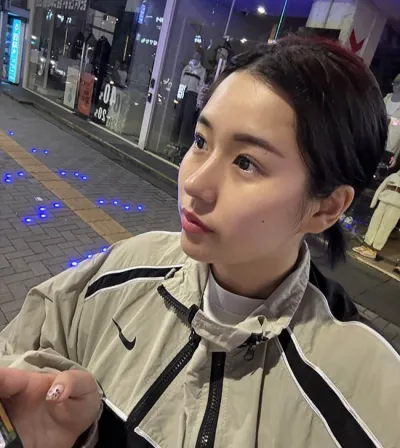 Mình đã phẫu thuật nâng mũi bằng sụn sườn tự thân không dùng sụn nhân tạo!!