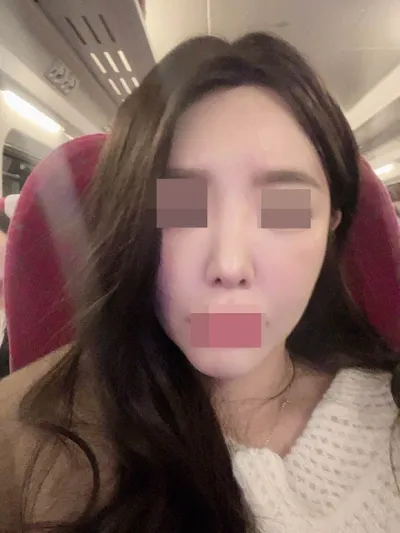 Sau khi phẫu thuật lại mũi, sự tự tin của mình cũng tăng lên :)