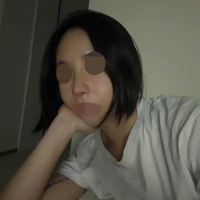 Review mình phẫu thuật lại mũi (sụn sườn tự thân) bởi Viện trưởng Kim Hyun-woo tại Want.