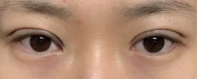 [Mắt] Kkulureuk - Mắt