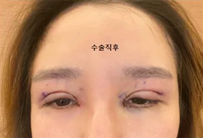 [Mắt] Naeuri Euri - Mắt