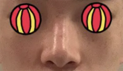 [Mũi] hyunee9801 - Mũi