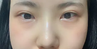 [Mũi] Pinku Panda - Mắt, Mũi