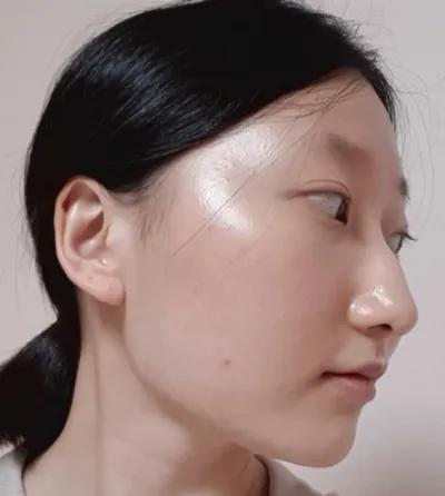 [Mũi] Kem đánh răng - Mũi