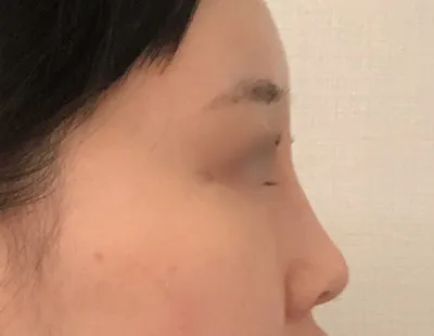 [Mắt] Chokho Kkeiku - Mắt, Mũi