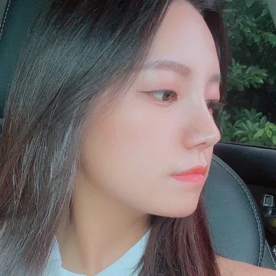 Phẫu thuật mũi được hai tháng, có vẻ như hết sưng tấy!