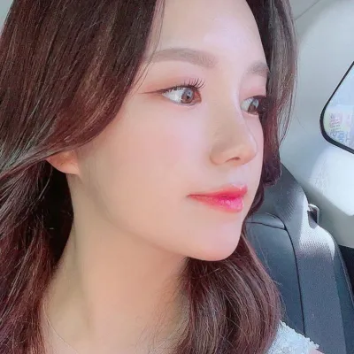 Đã 3 tháng kể từ khi mình phẫu thuật mũi tại Bệnh viện thẩm mỹ Weavers.