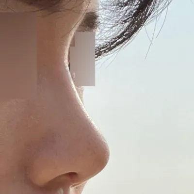 Hôm nay cuối cùng mình đã đi cắt chỉ bên trong!