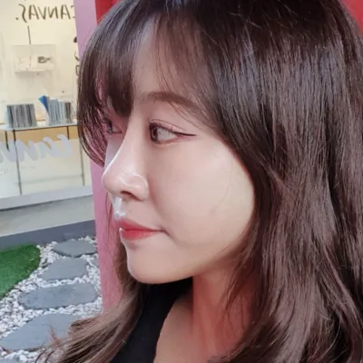 Đã 6 tháng kể từ khi mình phẫu thuật lại mũi