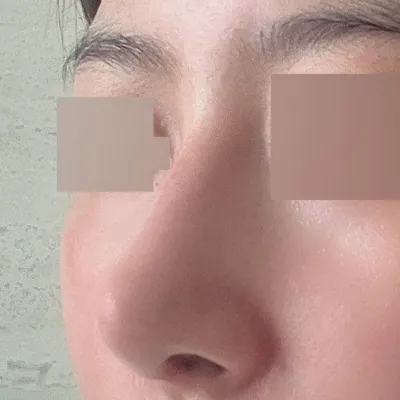 Cảm ơn bác sĩ Seo Seung-jo đã giúp mình có một chiếc mũi mới!