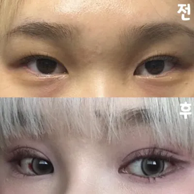 Rất hài lòng với ca phẫu thuật. Mọi người hãy đến Weavers nhé!!