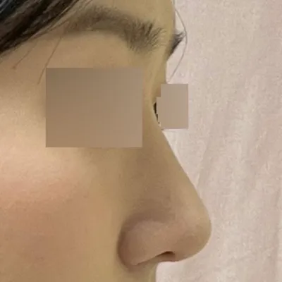 Mình rất thích chiếc mũi mới mà bạn đã tạo cho mình keke