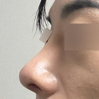 Những ai đang cân nhắc phẫu thuật lại hãy đến gặp bác sĩ Shim nhé