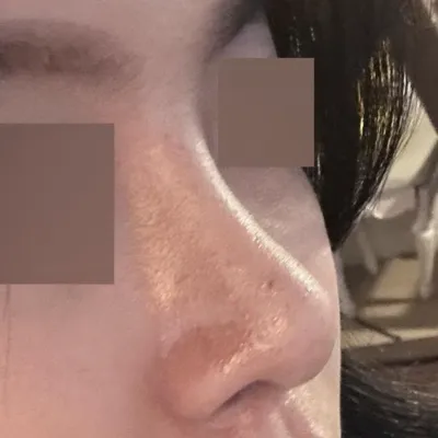 Mình nghe mọi người xung quanh khen mũi đẹp suốt ngày ㅎㅎ