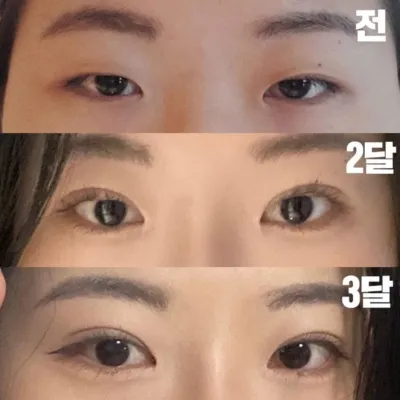 Đã được 3 tháng rồi nhưng trông rất tự nhiên