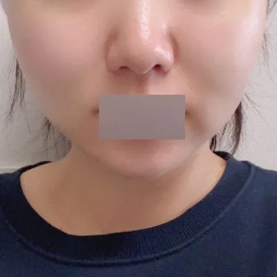 Mình nghĩ rằng bàn tay của bác sĩ Shim Jung Hwan rất tinh tế