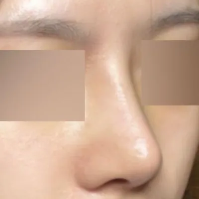 Đây là ca phẫu thuật đầu tiên nhưng mình cảm thấy rất thành công