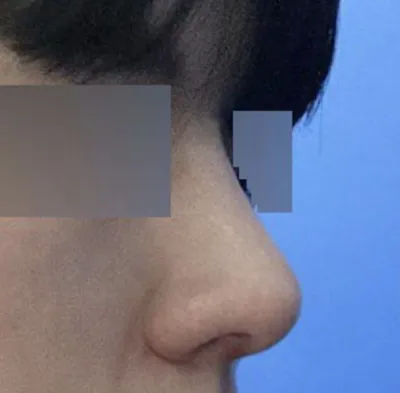 Giờ thì mình đã hiểu tại sao mọi người nói đàn ông nên có sống mũi thẳng rồiㅋㅋㅋ