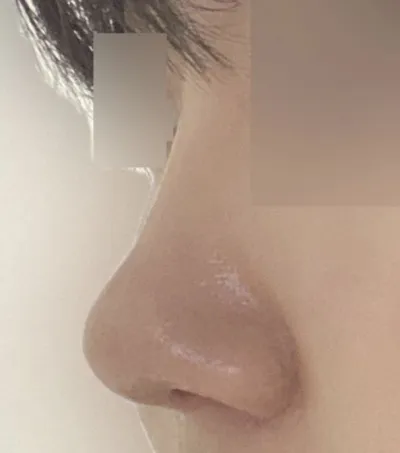 Mình hài lòng vì nó trông rất tự nhiên