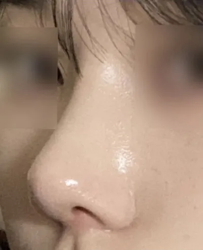 Mình đặc biệt thích điểm họ xem xét chiếc mũi phù hợp với tỷ lệ khuôn mặt của mình.