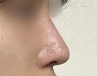 Mình rất vui vì có được chiếc mũi ưng ý!