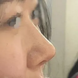 Bây giờ mình rất hài lòng nên lúc nào soi gương cũng phải trầm trồ...