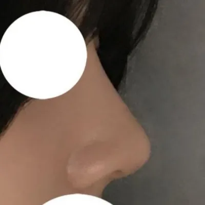 Đường nét mũi của mình trông rất đẹp khi chụp ảnh!