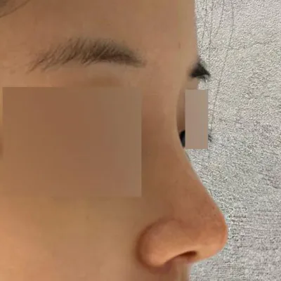 Đã hai tháng kể từ khi phẫu thuật