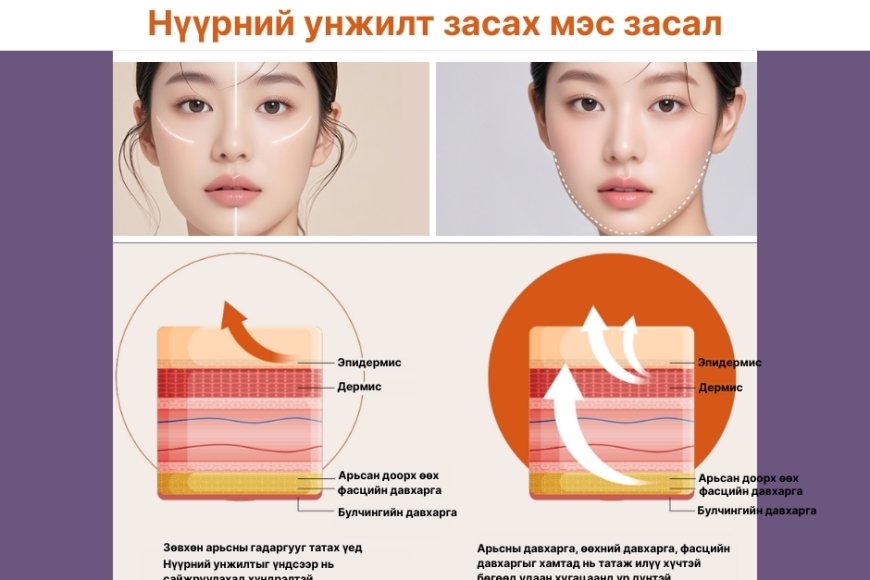 🧠 Da mặt chảy xệ – Tại sao chỉ căng da là không đủ?