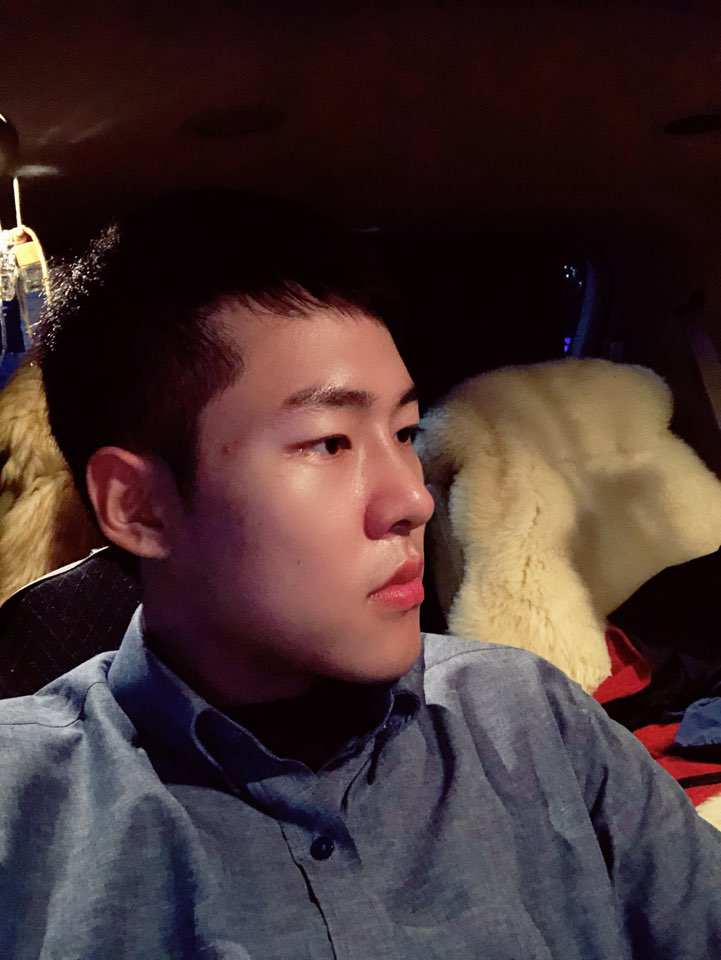 Review sau phẫu thuật nâng mũi cho nam