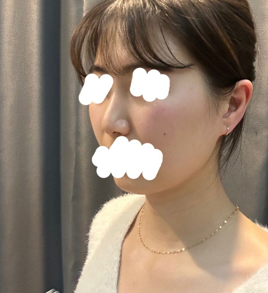 너무 맘에들어요 베리굿 성형외과 최고 최고