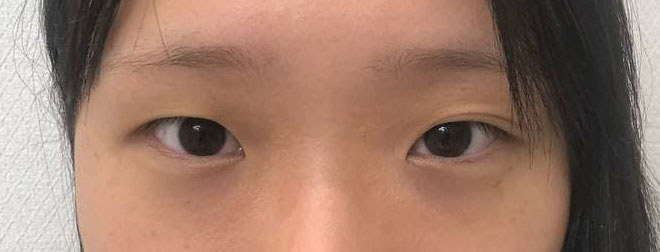 이쁘게 잘되서 너무 만족하면서 살고 있어요!!