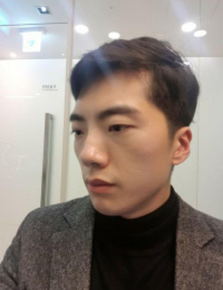 눈 | 코 | 안면윤곽 수술후기