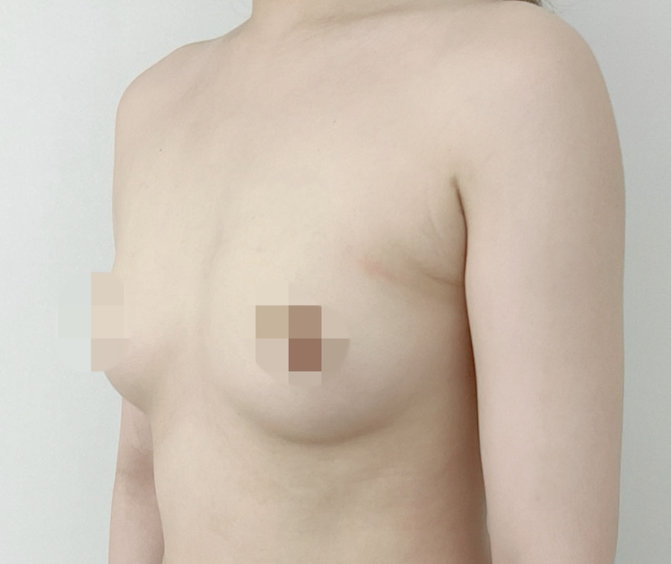 세빈서브6달차) ☆75B에서 65E☆ 비대칭 개선까지☆