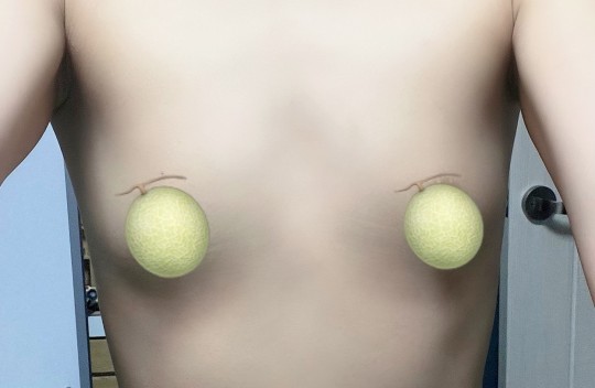 멘엑 2달차) 김주원 원장님 진짜 신의 손!!