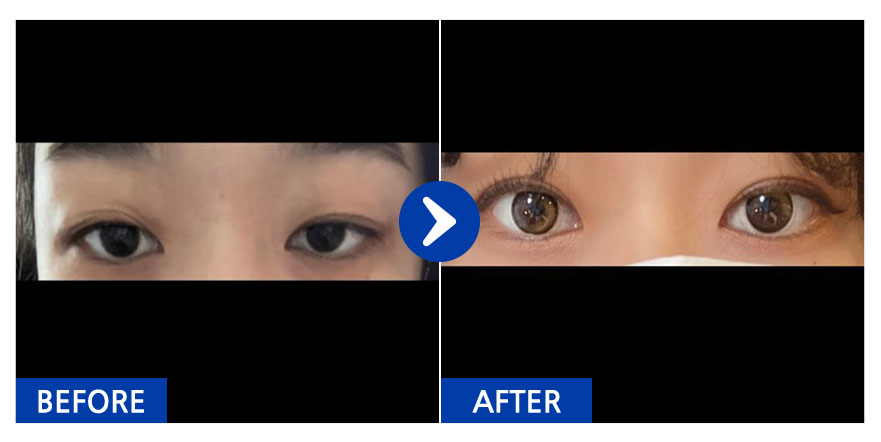 [바비톡] 자연유착 / 2주차 / 닉네임 : 트니와친구들