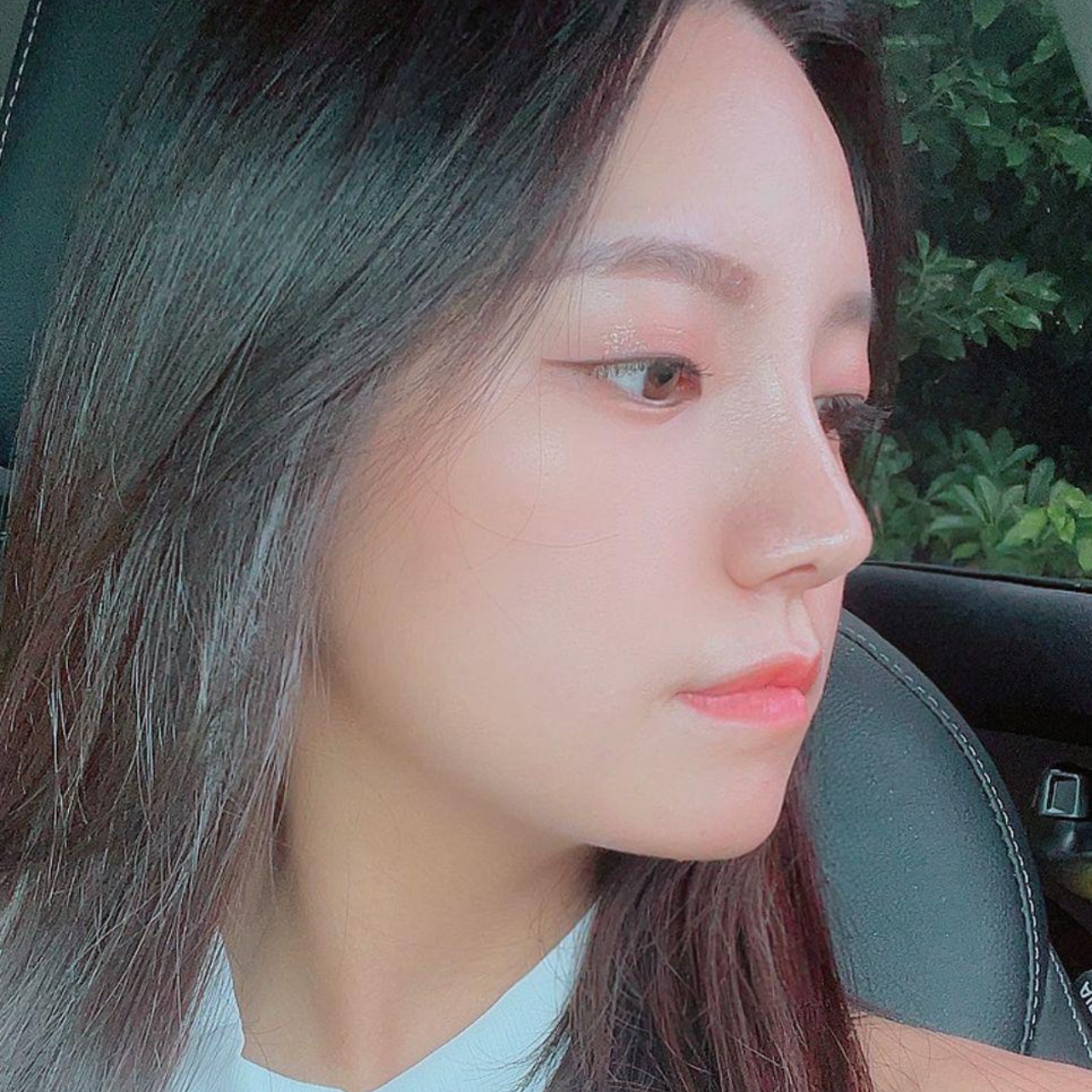 Phẫu thuật mũi được hai tháng, có vẻ như hết sưng tấy!