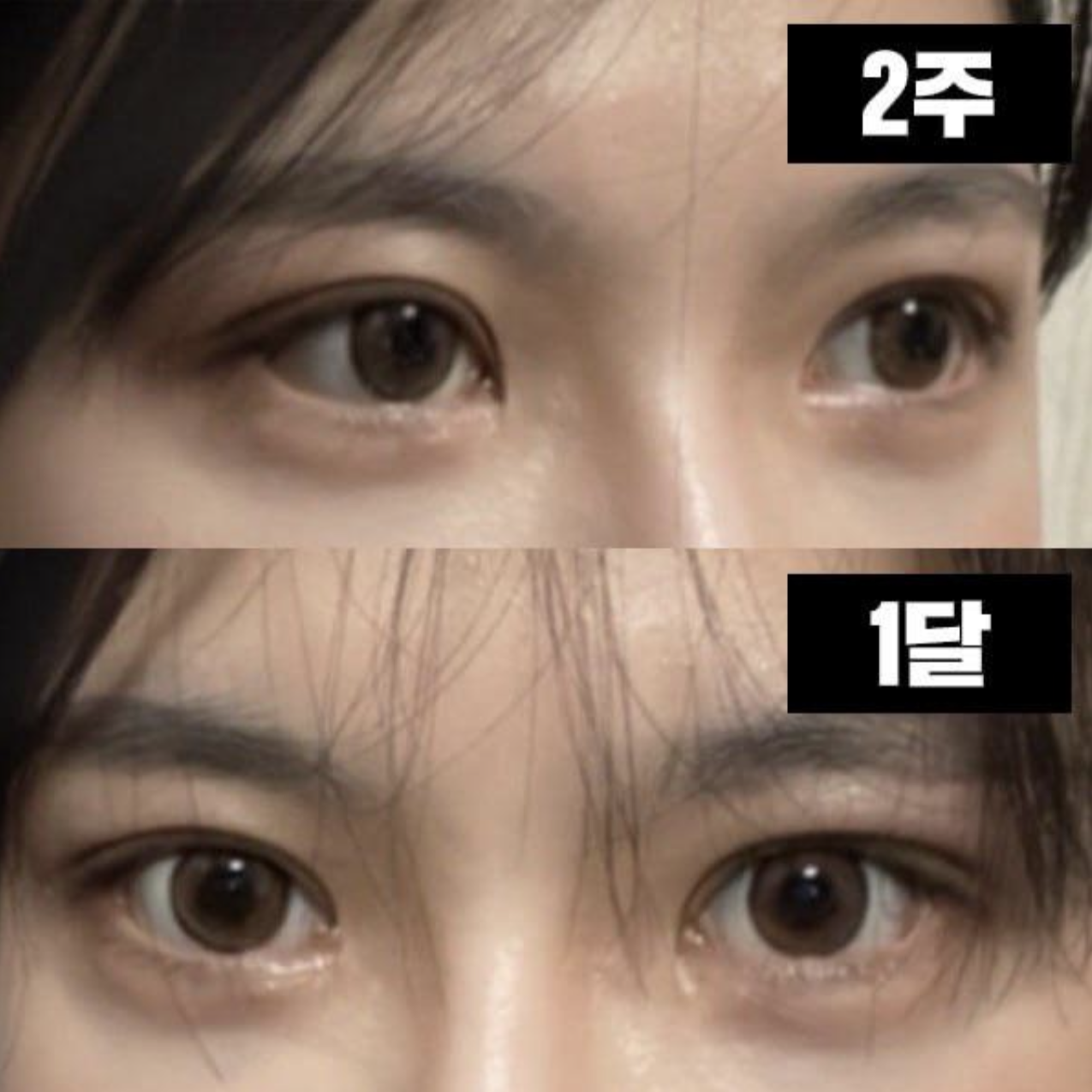 Cắt chỉ xong, thời gian trôi qua nhanh như chớp!