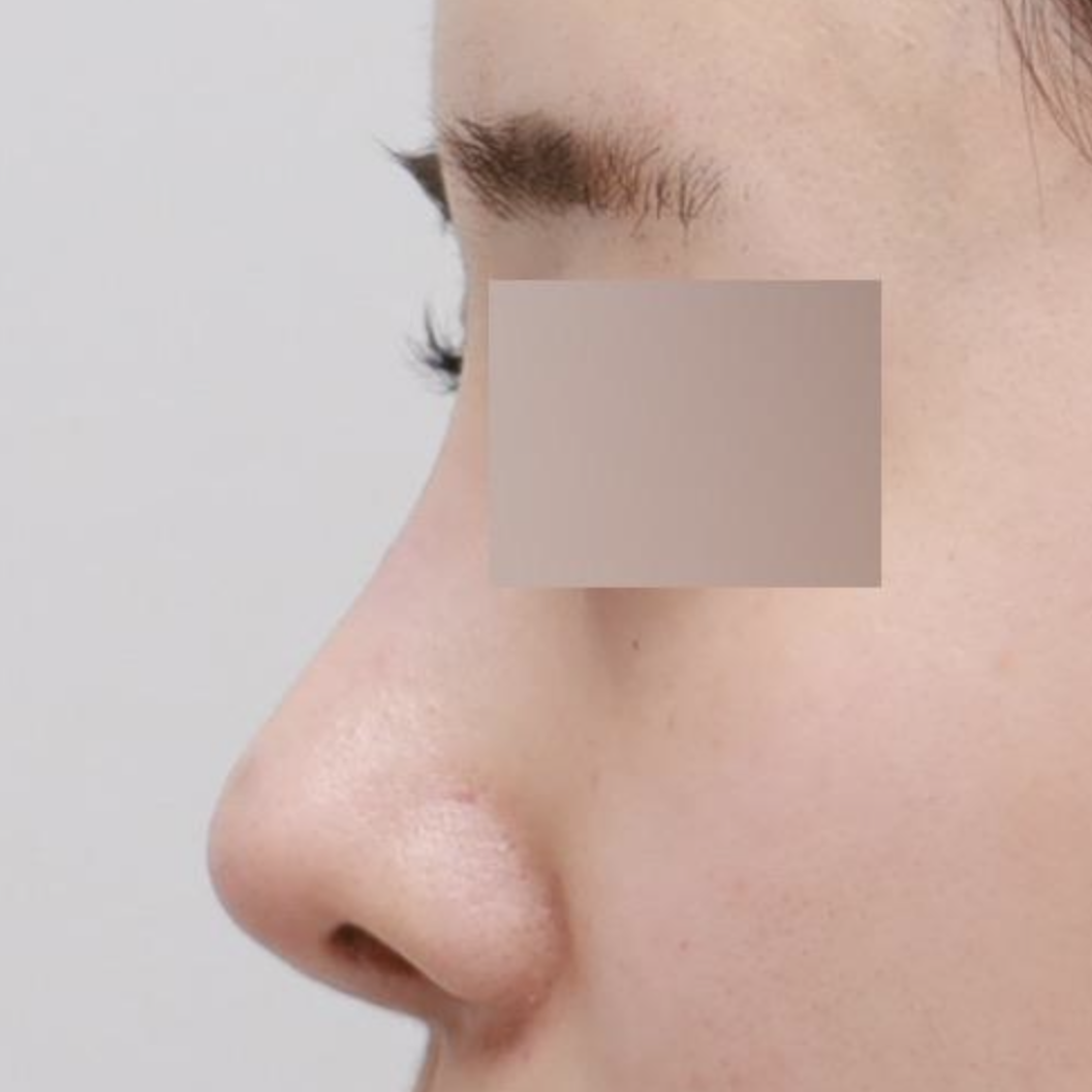 Mình rất thích dáng mũi hiện tại~~