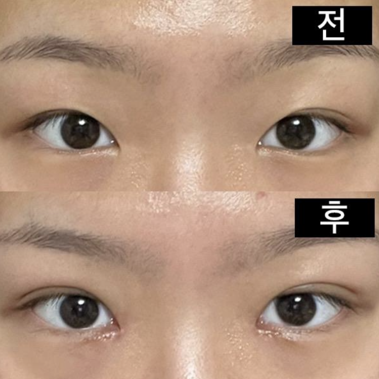 Tất cả ảnh trước/sau đều được chụp bằng camera thường!