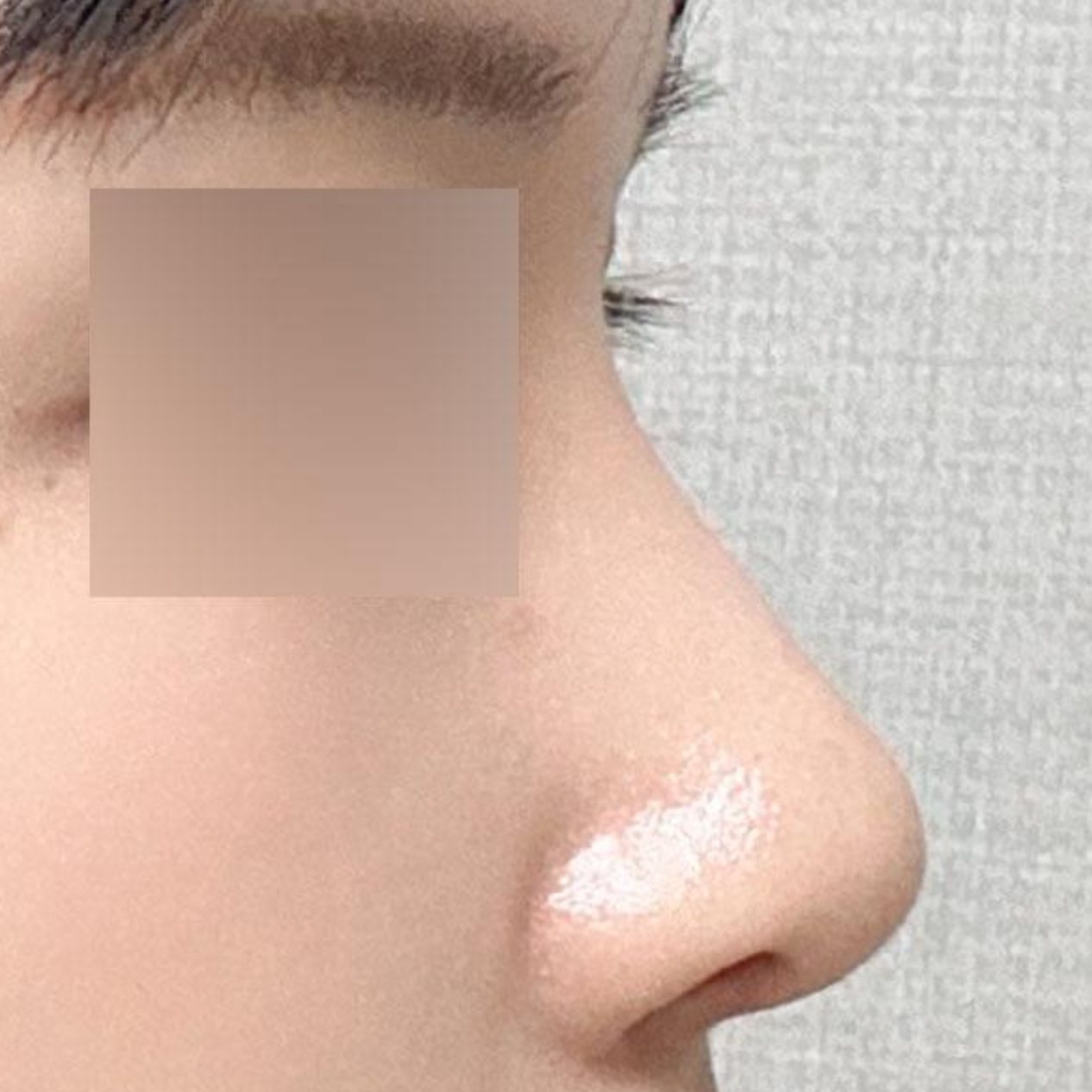 Mọi người xung quanh đều nói là đẹp lên rất nhiều