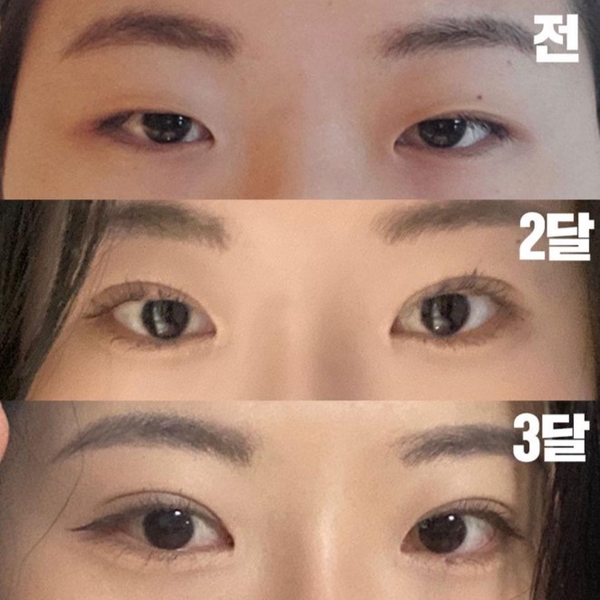 Đã được 3 tháng rồi nhưng trông rất tự nhiên