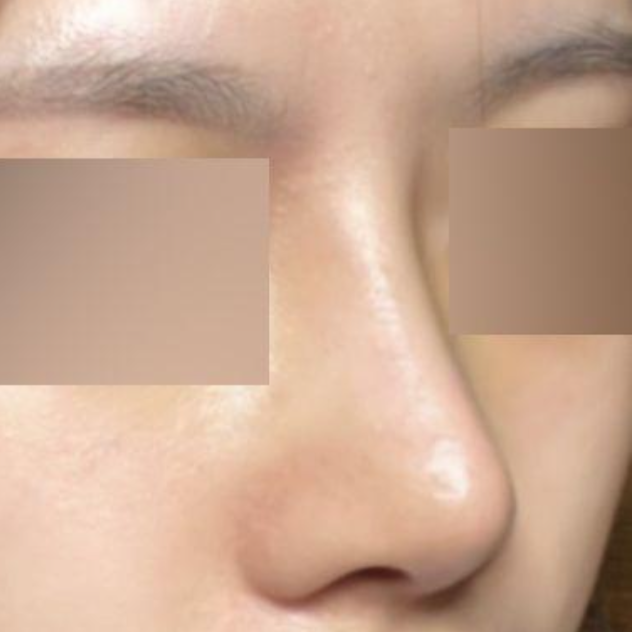 Đây là ca phẫu thuật đầu tiên nhưng mình cảm thấy rất thành công