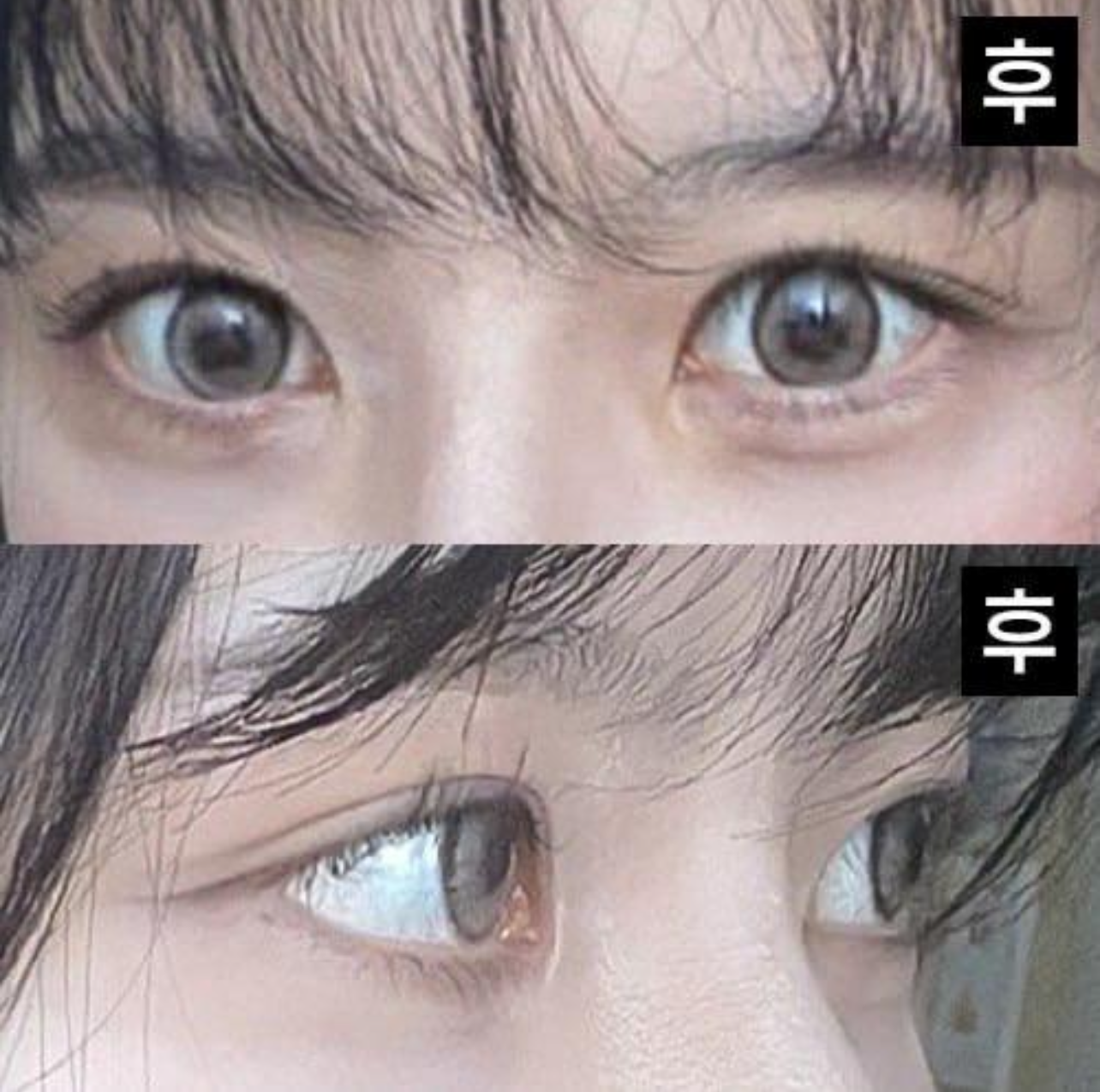 Mình nghĩ rằng mình đã làm rất tốt khi tin tưởng và giao phó cho bác sĩ, mình không hề hối hận.