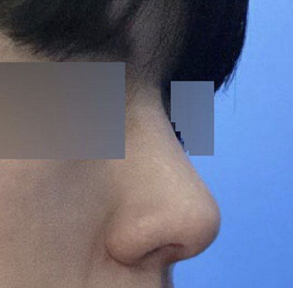 Giờ thì mình đã hiểu tại sao mọi người nói đàn ông nên có sống mũi thẳng rồiㅋㅋㅋ