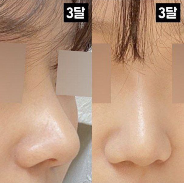 Mình thích tất cả sống mũi và đầu mũi!