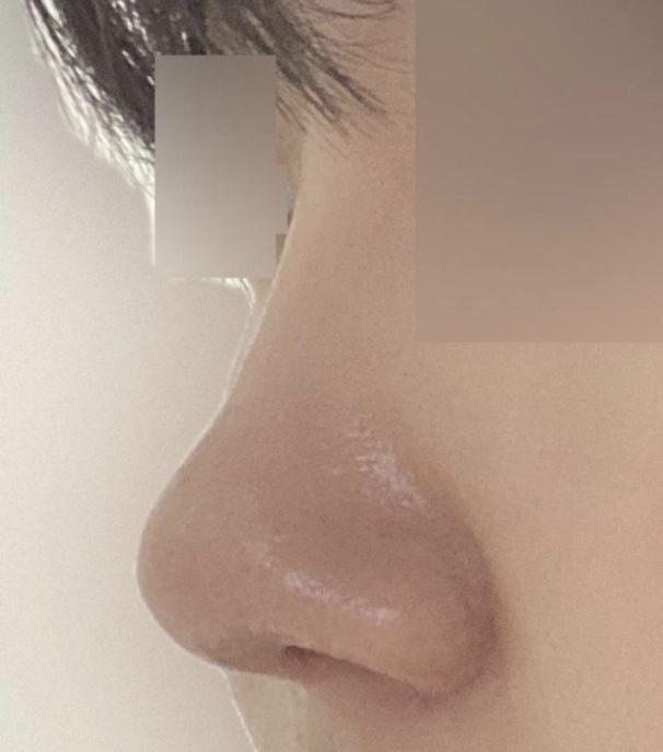 Mình hài lòng vì nó trông rất tự nhiên